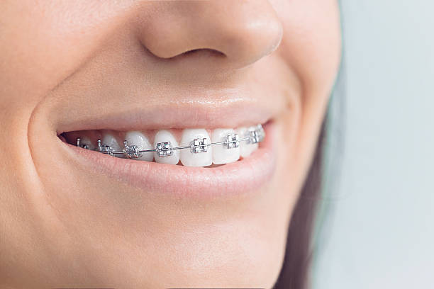 Best Traditional Braces  in Setauket, NY